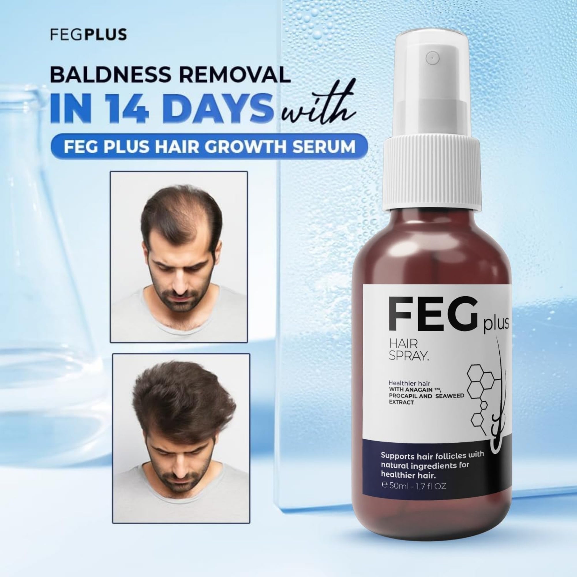 FEG Plus hair growth serum bottle with before and after images on a blue background