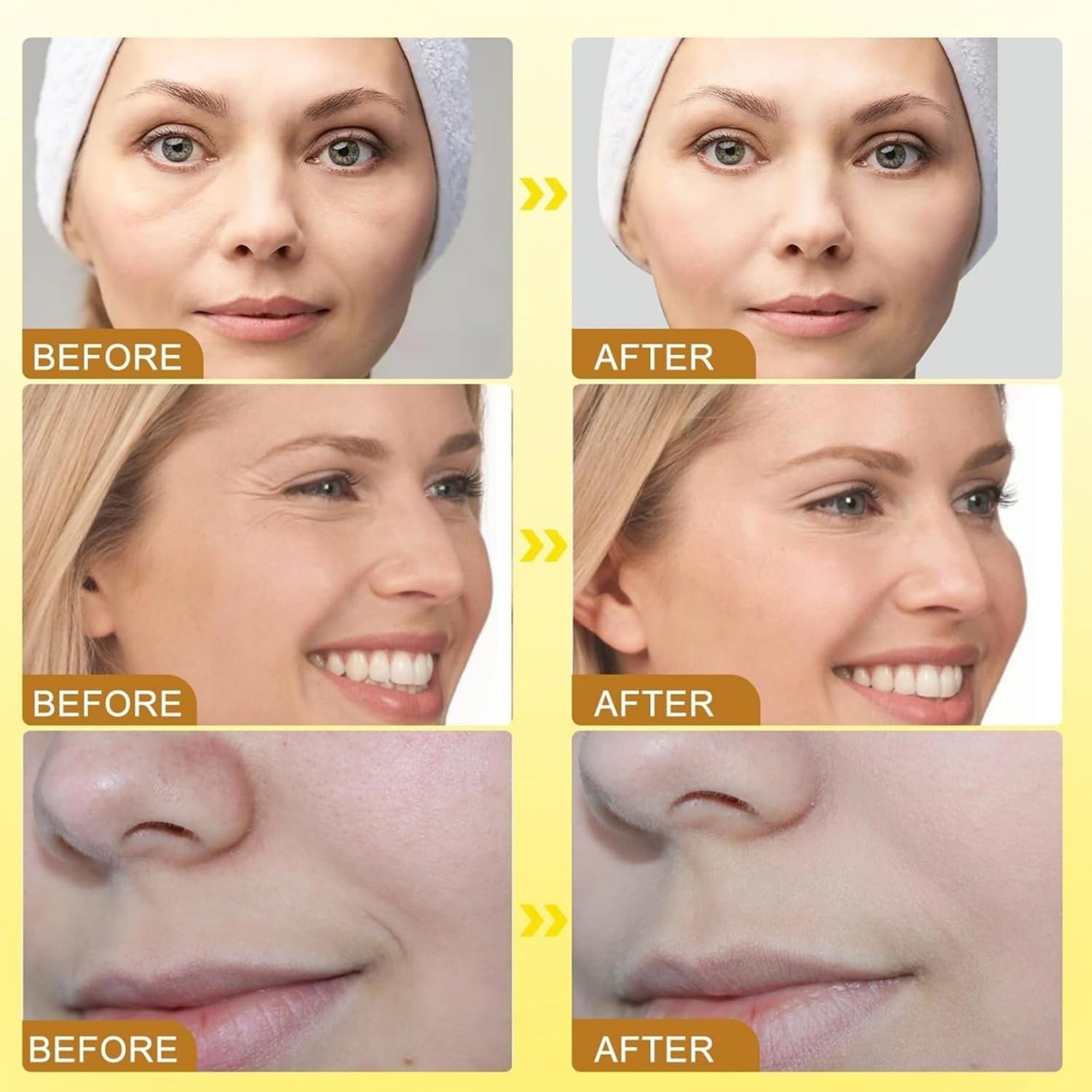 Botox Bee Venom Wrinkle Cream in Pakistan | Anti-Aging & Collagen Boosting Moisturizer