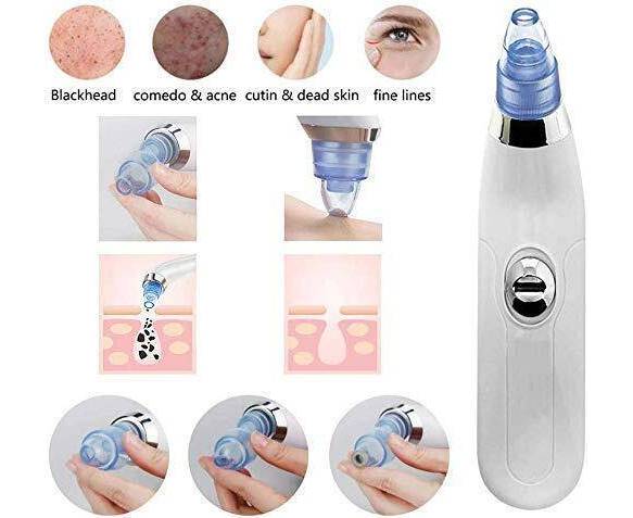 Blackhead Removal Machine | Derma Suction 3 In 1 Black Head Remover Machine